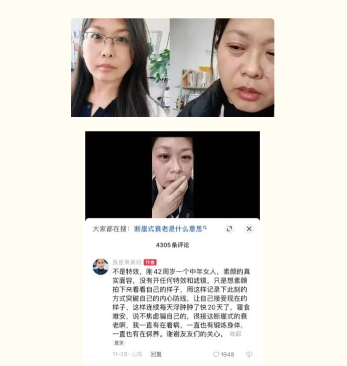 斷崖式衰老女子確診卵巢早衰，生活習慣是衰老“加速器”